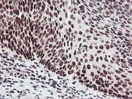 HOXC11 Antibody (aa1-304, clone OTI3E10, Carrier-free)