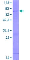 Human ST6GALNAC2 Protein (Recombinant GST)