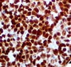 Monoclonal Mouse anti-Human Muscle Actin Antibody (clone HHF-35, Ready-to-Use, IHC)