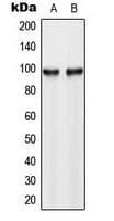 Polyclonal Rabbit anti-Human HK3 / Hexokinase 3 Antibody (C-Terminus, IHC, WB)
