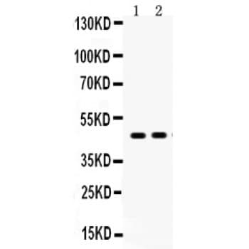 Polyclonal Rabbit anti-Human AGTR1 / AT1 Receptor Antibody (aa1-28, IHC, WB)
