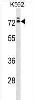 Polyclonal Rabbit anti-Human IL23R Antibody (aa428-457, WB)
