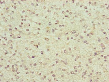 FBXO6 Antibody