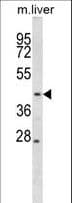 MAP2K2 / MKK2 / MEK2 Antibody (aa36-63)