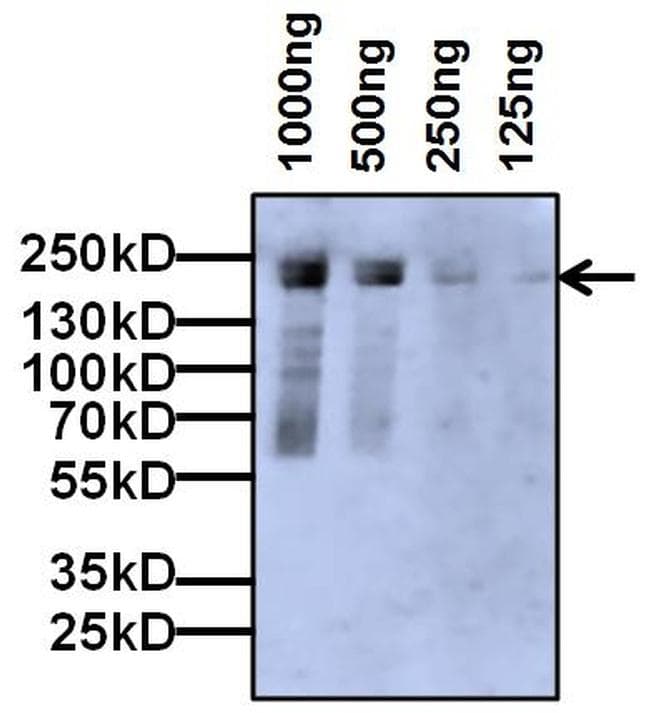 A2M / Alpha-2-Macroglobulin Antibody (clone F1-P1C11 #3)