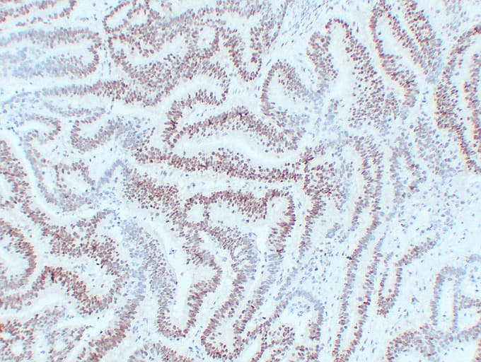 Monoclonal Mouse anti-Human MLH1 Antibody (clone ABT-MLH1, IHC, WB)