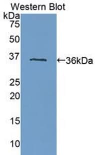 FLT1 / VEGFR1 Antibody (aa27-328, FITC)