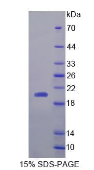 Human DNT / NT5C Protein (Recombinant)