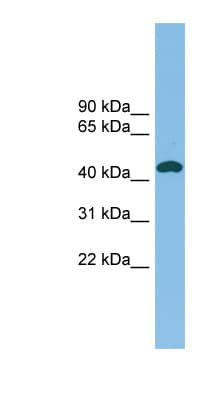 NODAL Antibody (C-Terminus)
