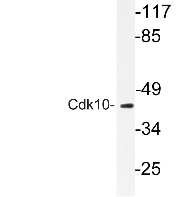 CDK10 Antibody (Glu63)