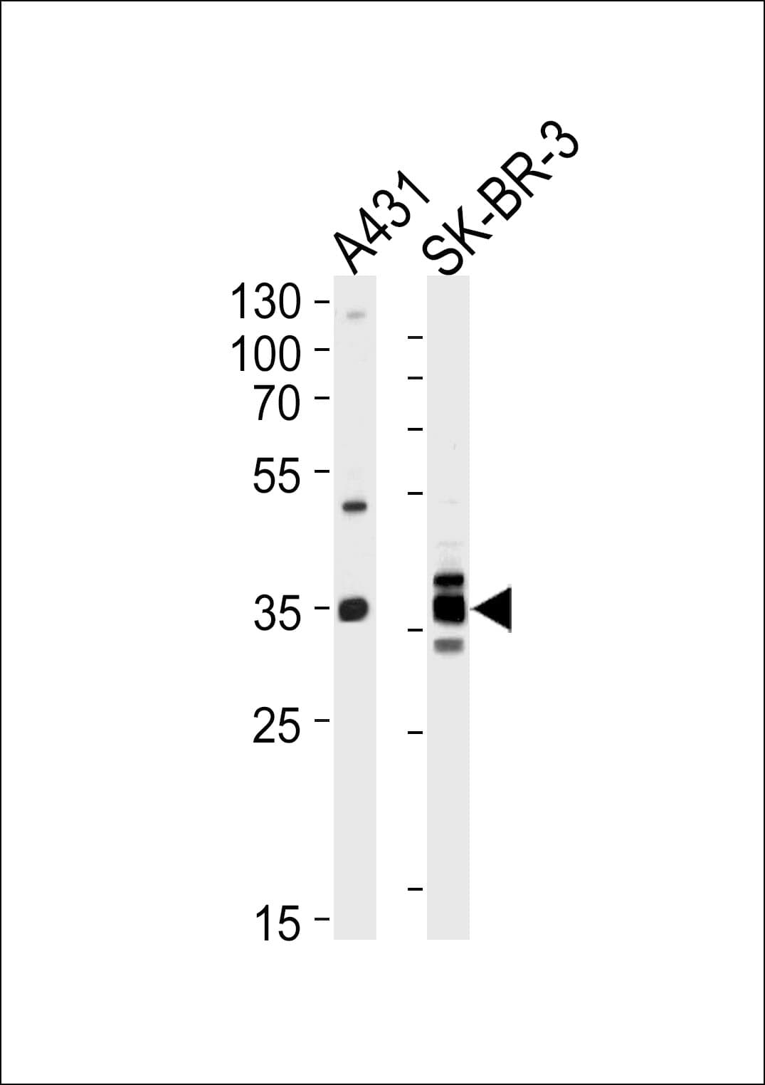 ANXA2 / Annexin A2 Antibody (aa287-313)