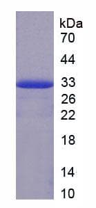 Rat F2 / Prothrombin / Thrombin Protein (Recombinant His)