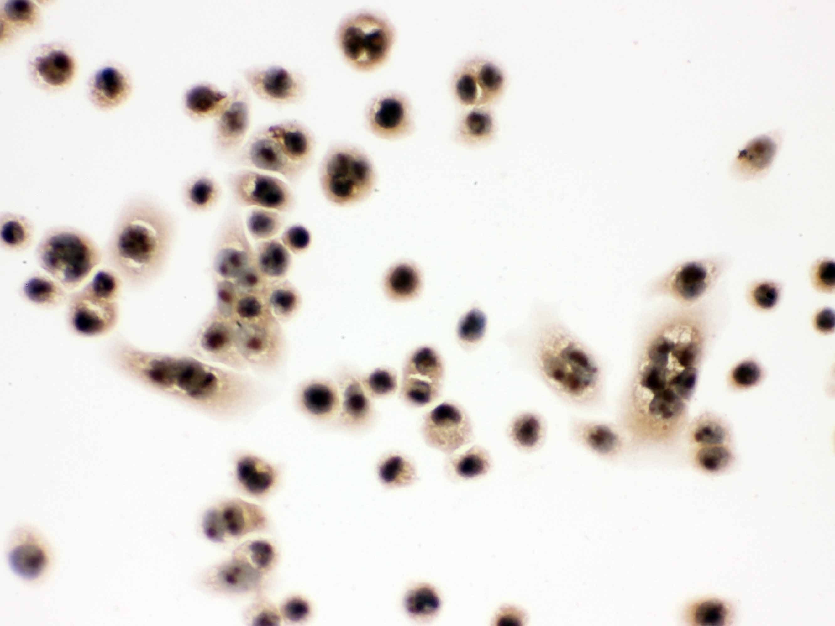 Polyclonal Rabbit anti-Human EIF6 Antibody (aa66-210, IHC, WB)