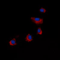 Polyclonal Rabbit anti-Human ARRDC4 Antibody (Internal, IHC, IF, WB)