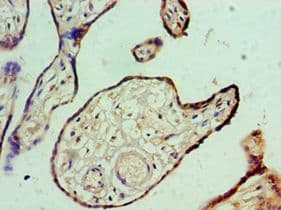 Polyclonal Rabbit anti-Human IL1RAP Antibody (aa21-356, IHC)