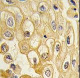 Polyclonal Rabbit anti-Human ROR1 Antibody (IHC, WB)
