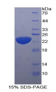 Human IL11 Protein (Recombinant His-T7)