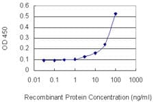 MAT / MAT1A Antibody (clone 4D11)