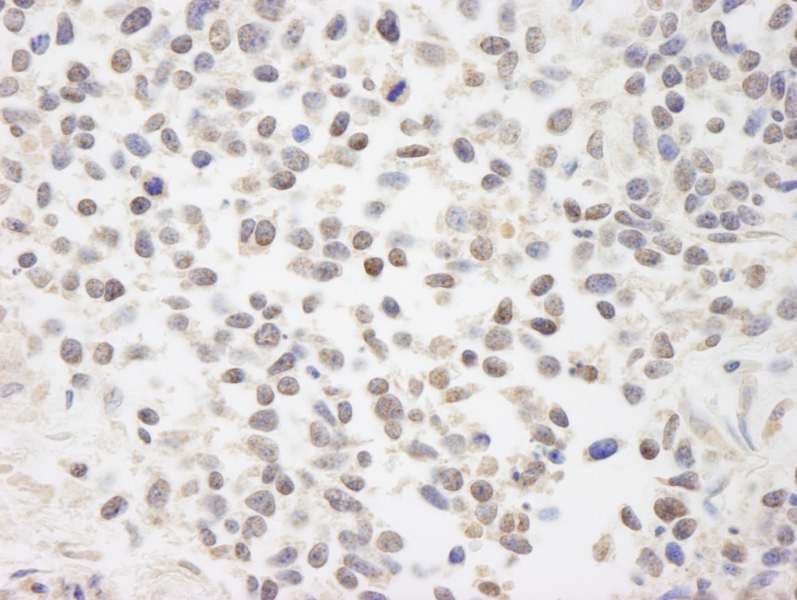 Polyclonal Rabbit anti-Human BRAT1 / BAAT1 Antibody (aa775-C-term, IHC)