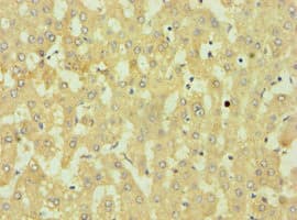 DKK4 Antibody (aa19-224)