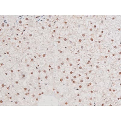 RELA / NFKB p65 Antibody (phospho-Ser281)