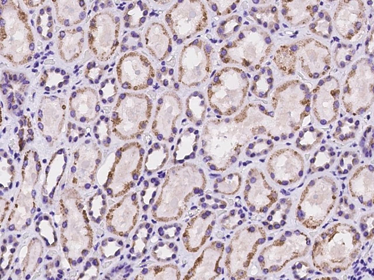 Polyclonal Rabbit anti-Human HLCS / HCS Antibody (IHC)