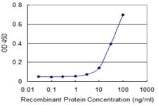 S100A5 Antibody (clone 5E1)