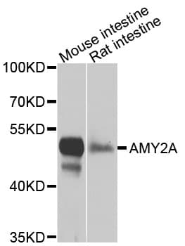 Polyclonal Rabbit anti-Human AMY2A / Pancreatic Amylase Antibody (IHC, WB)