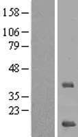 MRPS16 Protein (Over-Expression Lysate Myc-DDK (Flag))
