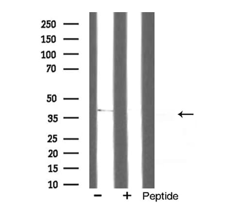 SUCNR1 / GPR91 Antibody