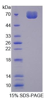 Mouse CKAP2 Protein (Recombinant)