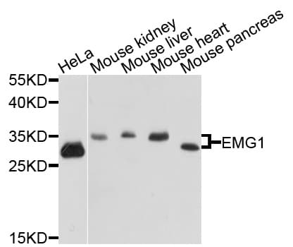 EMG1 / NEP1 Antibody