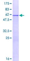 Human IL-33 Protein (Recombinant GST)