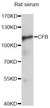 CFB / Complement Factor B Antibody