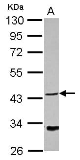 Polyclonal Rabbit anti-Human NDRG4 Antibody (WB)