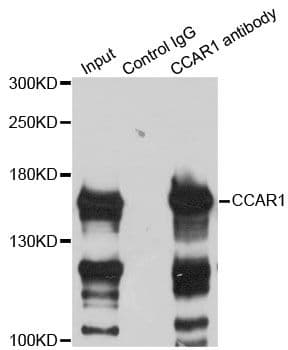 DIS / CCAR1 Antibody