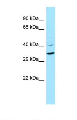 Polyclonal Rabbit anti-Human KRT9 / CK9 / Cytokeratin 9 Antibody (aa80-129, WB)