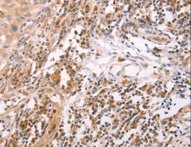 CIDEB Antibody