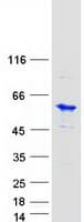 Human UBE2Q1 Protein (Recombinant Myc-DDK (Flag))