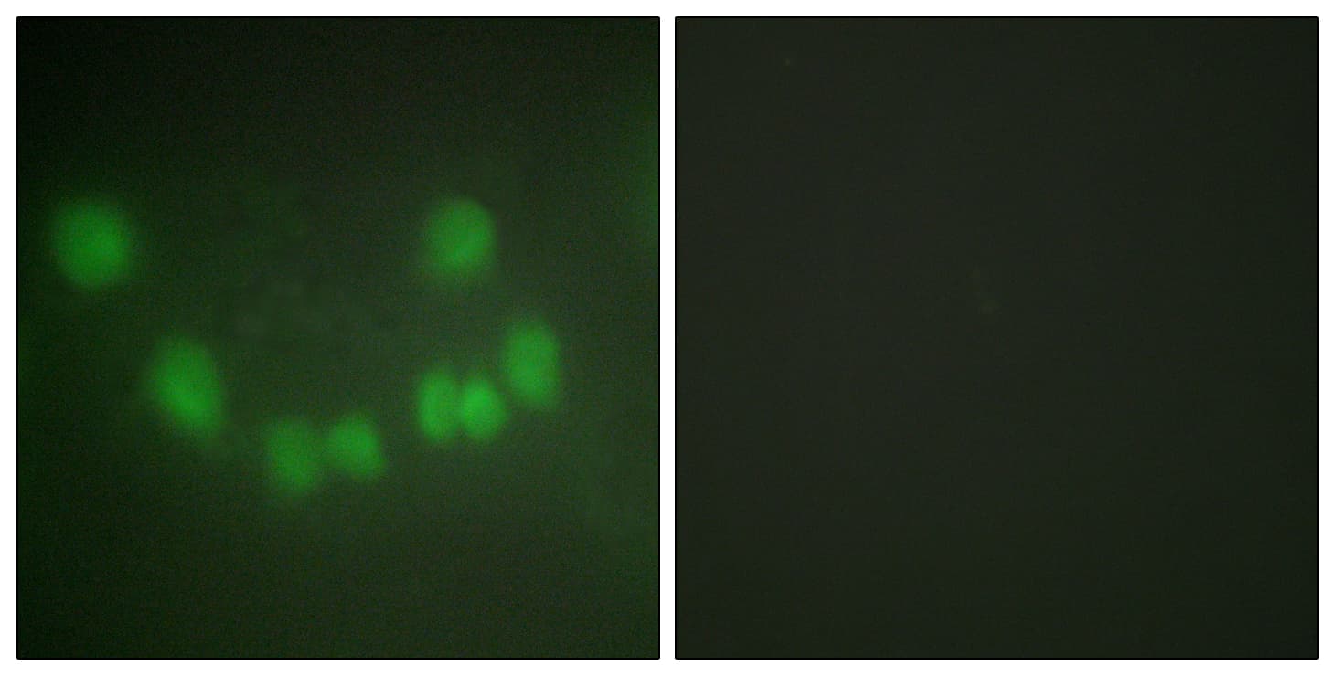 CDK1 / CDC2 Antibody (aa101-150)