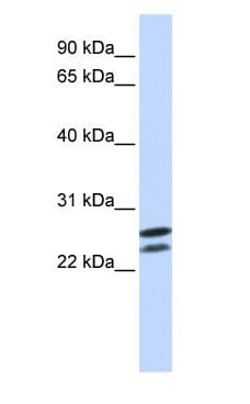 Polyclonal Rabbit anti-Human HOXB4 Antibody (N-Terminus, WB)