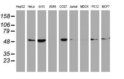 TUBB4 / Tubulin Beta 4 Antibody (clone OTI3F1, Carrier-free)
