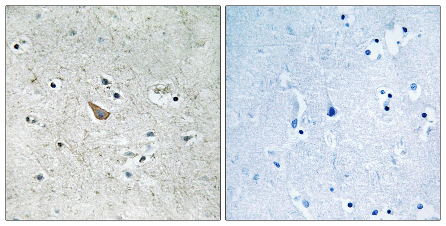 Ephrin B1+B2 Antibody (phospho-Tyr329)