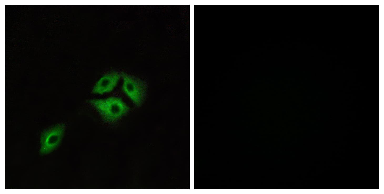 Polyclonal Rabbit anti-Human NMBR Antibody (aa221-270, IF, WB)