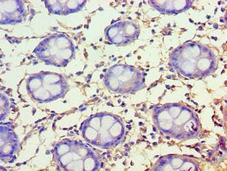 FAM160B1 Antibody (aa1-738)