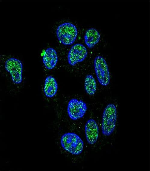 ZNF202 Antibody (aa342-370)
