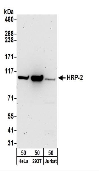 Polyclonal Rabbit anti-Human HDGFRP2 Antibody (aa621-671, WB)