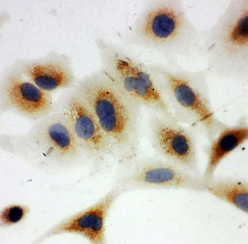 Polyclonal Rabbit anti-Human NDUFA1 Antibody (aa54-70, IHC, WB)