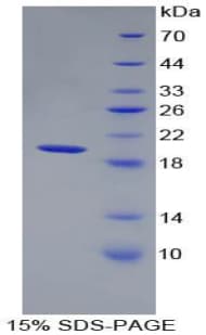 Mouse MMP9 / Gelatinase B Protein (Recombinant His)