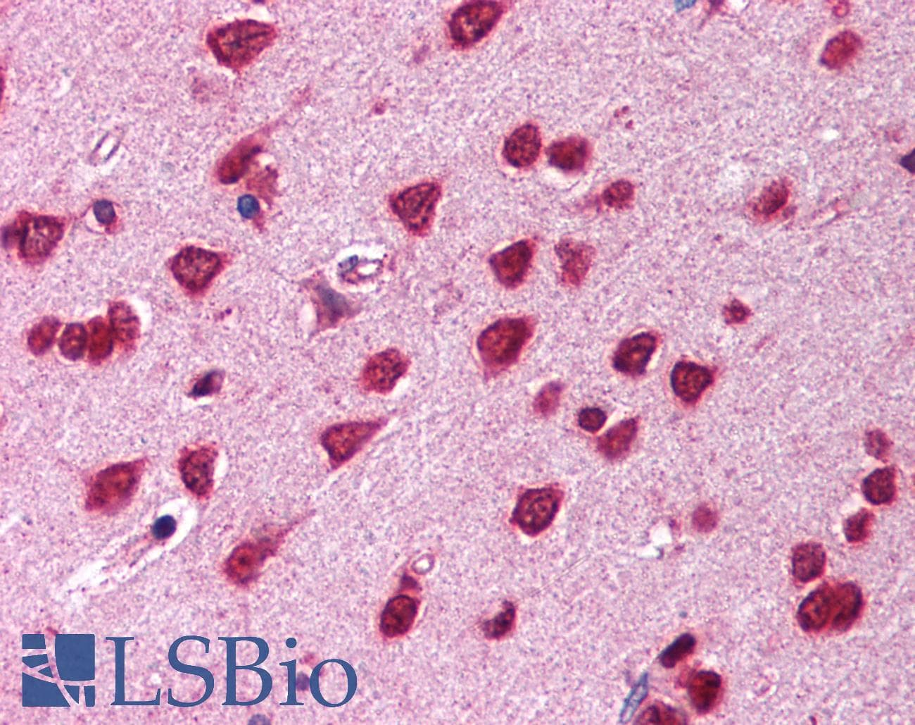 IHC-plus™ ARNTL / BMAL1 Antibody (aa294-624)